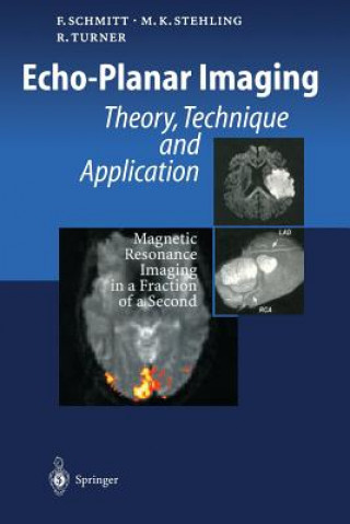 Book Echo-Planar Imaging Franz Schmitt