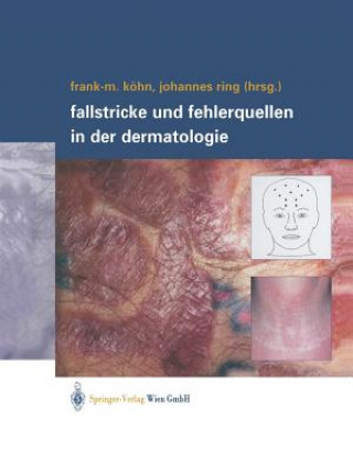Kniha Fallstricke Und Fehlerquellen in Der Dermatologie Frank-Michael Köhn