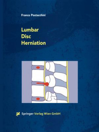 Kniha Lumbar Disc Herniation Franco Postacchini