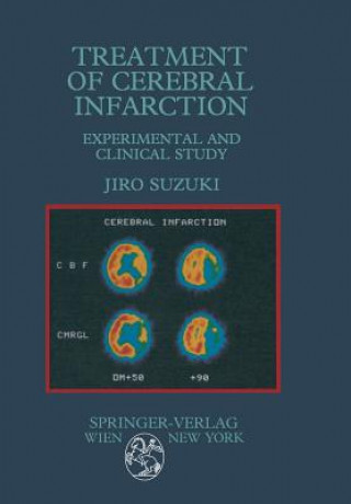 Kniha Treatment of Cerebral Infarction Jiro Suzuki