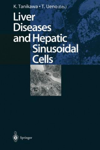 Książka Liver Diseases and Hepatic Sinusoidal Cells Kyuichi Tanikawa