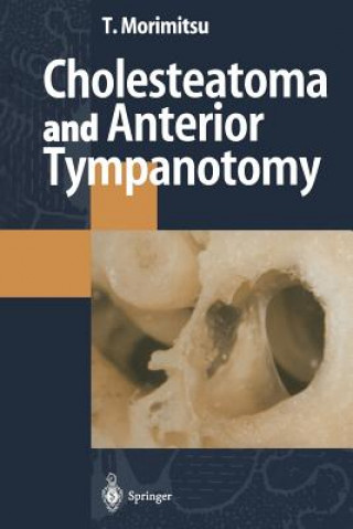 Carte Cholesteatoma and Anterior Tympanotomy Tamotsu Morimitsu