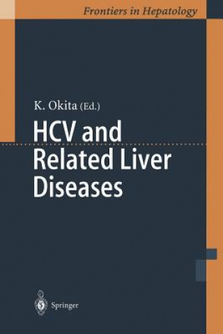 Carte HCV and Related Liver Diseases Kiwamu Okita