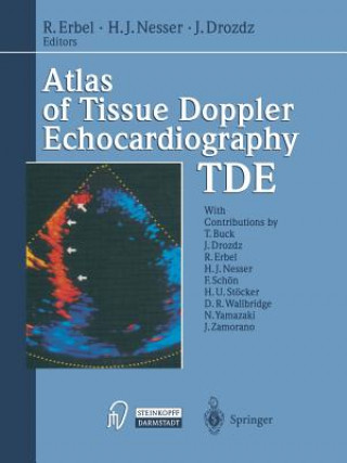 Kniha Atlas of Tissue Doppler Echocardiography - TDE Raimund Erbel