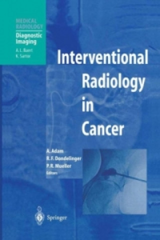 Kniha Interventional Radiology in Cancer Andreas Adam