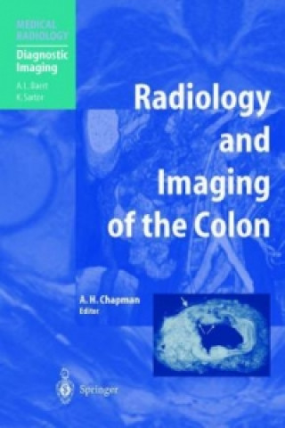 Książka Radiology and Imaging of the Colon Anthony H. Chapman