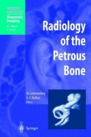 Carte Radiology of the Petrous Bone Marc Lemmerling