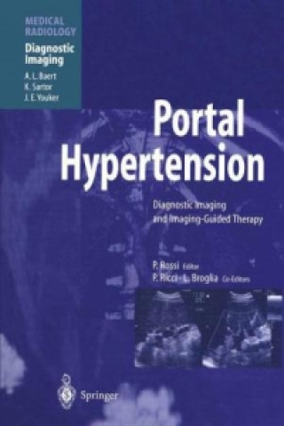 Kniha Portal Hypertension Plinio Rossi