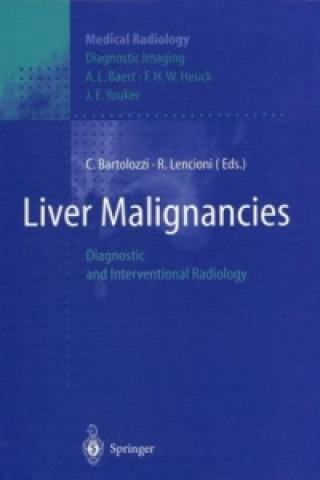 Kniha Liver Malignancies C. Bartolozzi
