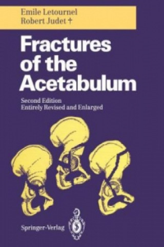 Könyv Fractures of the Acetabulum Emile Letournel