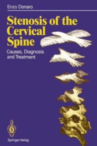 Kniha Stenosis of the Cervical Spine Vincenzo Denaro