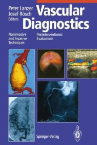 Knjiga Vascular Diagnostics Peter Lanzer