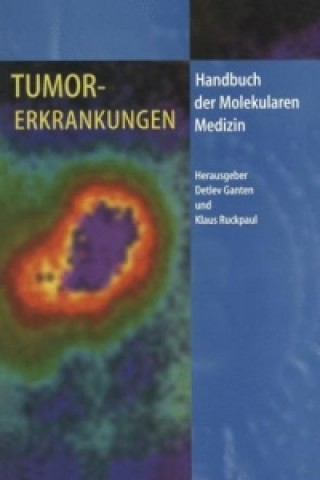 Book Tumorerkrankungen Detlev Ganten