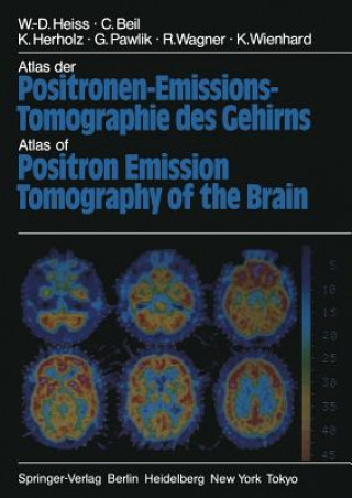 Carte Atlas der Positronen-Emissions-Tomographie des Gehirns / Atlas of Positron Emission Tomography of the Brain W.-D. Heiss