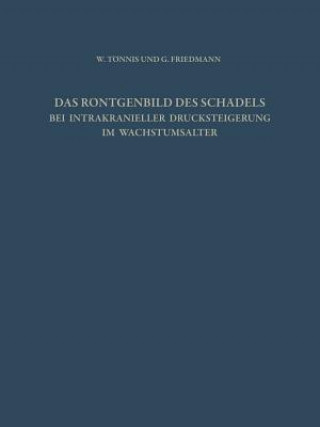 Książka Das R ntgenbild Des Sch dels Bei Intrakranieller Drucksteigerung Im Wachstumsalter W. Tönnis