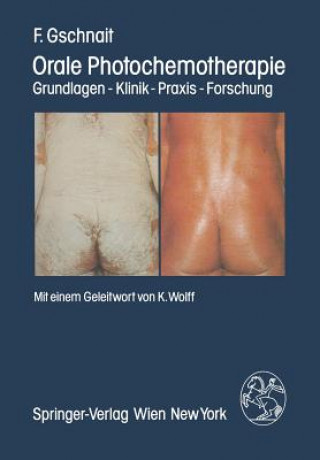 Kniha Orale Photochemotherapie F. Gschnait