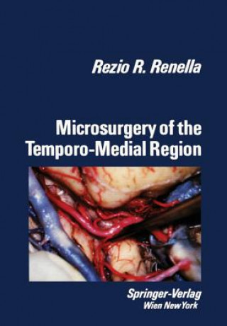 Kniha Microsurgery of the Temporo-Medial Region Rezio R. Renella