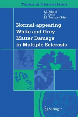 Книга Normal-appearing White and Grey Matter Damage in Multiple Sclerosis M. Filippi