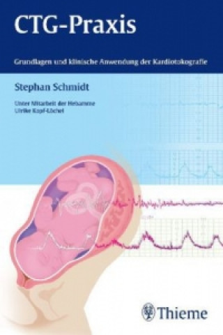 Könyv CTG-Praxis Stephan Schmidt