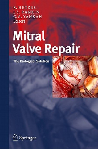 Kniha Mitral Valve Repair Roland Hetzer