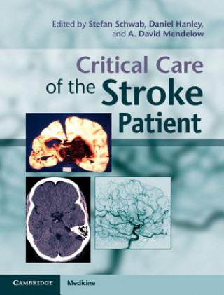 Book Critical Care of the Stroke Patient Stefan Schwab