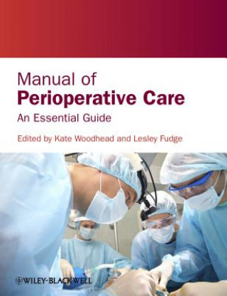 Carte Manual of Perioperative Care - An Essential Guide Kate Woodhead