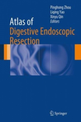 Könyv Atlas of Digestive Endoscopic Resection Pinghong Zhou