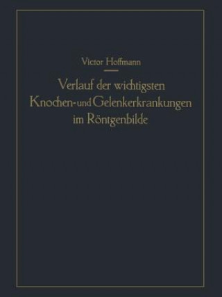 Könyv Verlauf Der Wichtigsten Knochen- Und Gelenkerkrankungen Im Roentgenbilde Victor Hoffmann