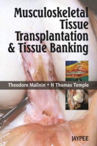 Book Musculoskeletal Tissue Transplantation and Tissue Banking Theodore Malinin