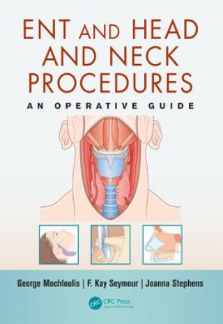 Knjiga ENT and Head and Neck Procedures George Mochloulis & F Kay Seymour