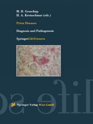 Carte Prion Diseases Martin H. Groschup