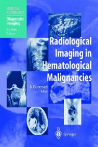 Kniha Radiological Imaging in Hematological Malignancies Ali Guermazi