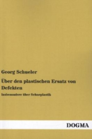 Könyv Über den plastischen Ersatz von Defekten Georg Schueler