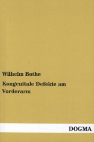 Kniha Kongenitale Defekte am Vorderarm Wilhelm Bothe