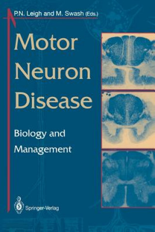 Könyv Motor Neuron Disease P.N. Leigh