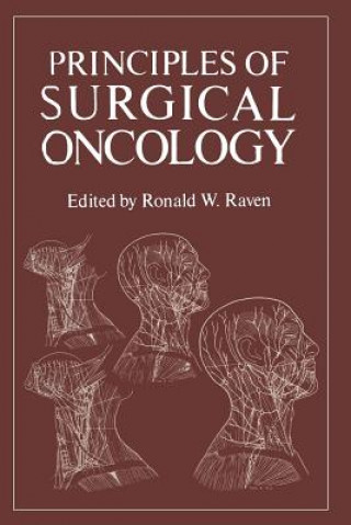 Książka Principles of Surgical Oncology Ronald Raven