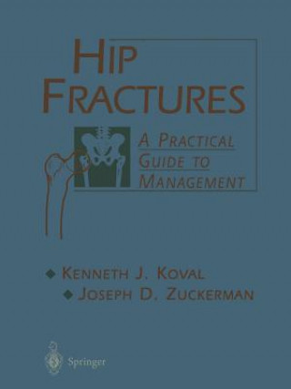 Knjiga Hip Fractures Kenneth Koval