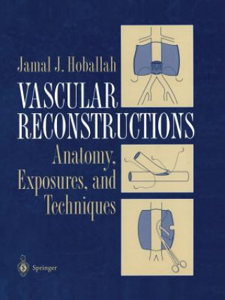 Kniha Vascular Reconstructions Jamal J. Hoballah