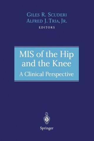 Carte MIS of the Hip and the Knee Giles R. Scuderi