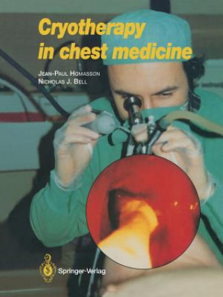 Libro Cryotherapy in Chest Medicine JEAN-PAUL HOMASSON