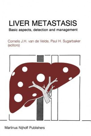 Könyv Liver Metastasis Cornelis J.H. van de Velde