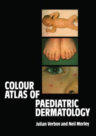 Kniha Colour Atlas of Paediatric Dermatology J. Verbov