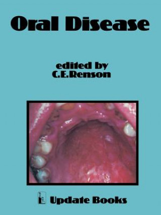Könyv Oral Disease C.E. Renson