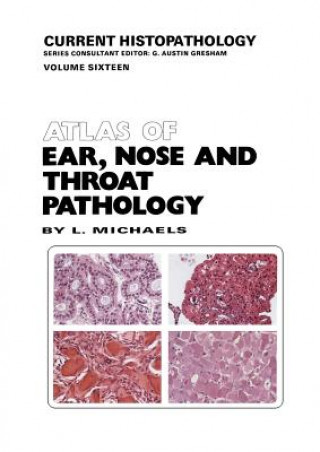 Kniha Atlas of Ear, Nose and Throat Pathology L. Michaels