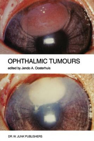 Carte Ophthalmic Tumours Jendo A. Oosterhuis