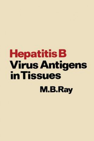 Carte Hepatitis B Virus Antigens in Tissues M.B. Ray