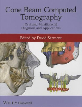 Kniha Cone Beam Computed Tomography - Oral and Maxillofacial Diagnosis and Applications David Sarment