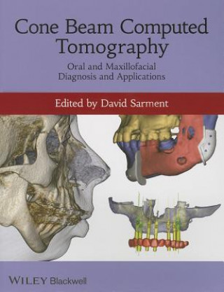 Book Cone Beam Computed Tomography - Oral and Maxillofacial Diagnosis and Applications David Sarment