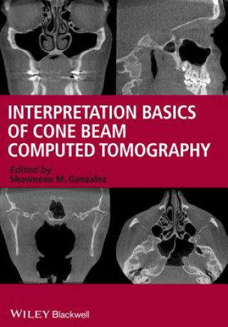Kniha Interpretation Basics of Cone Beam Computed Tomography Shawneen M Gonzalez