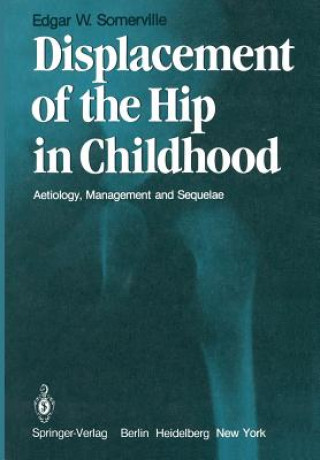 Kniha Displacement of the Hip in Childhood E.W. Somerville